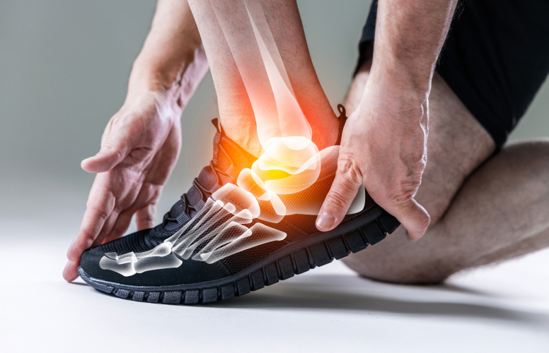 Image of Ankle Injury